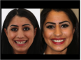 Innovative Zahnästhetik – Mit Digital Smile Design heute wissen, wie ich morgen aussehe