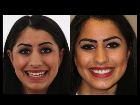 Innovative ZahnÃ¤sthetik â€“ Mit Digital Smile Design heute wissen, wie ich morgen aussehe